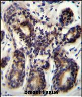 NBPF8 Antibody in Immunohistochemistry (Paraffin) (IHC (P))