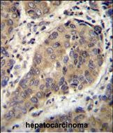 WTIP Antibody in Immunohistochemistry (Paraffin) (IHC (P))