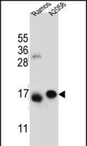 EIF5AL1 Antibody in Western Blot (WB)