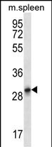 Krt222 Antibody in Western Blot (WB)