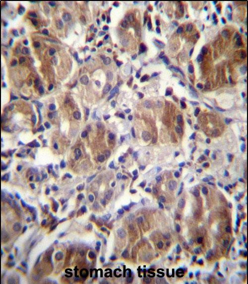 DULLARD Antibody in Immunohistochemistry (Paraffin) (IHC (P))