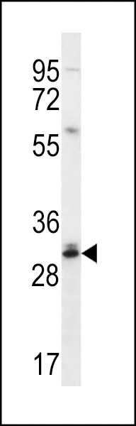 DULLARD Antibody in Western Blot (WB)