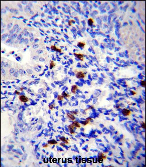 TNN Antibody in Immunohistochemistry (Paraffin) (IHC (P))