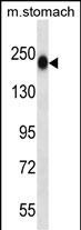 TNN Antibody in Western Blot (WB)