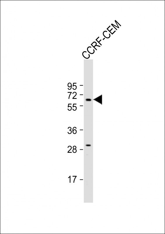 DYTN Antibody in Western Blot (WB)