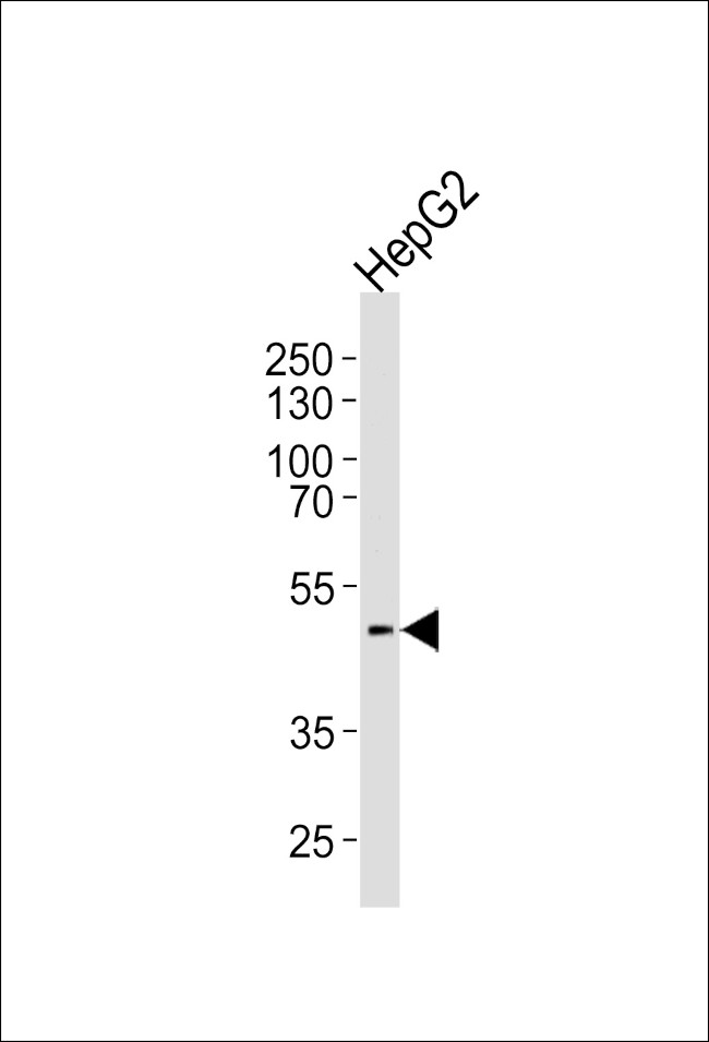 HHCM Antibody in Western Blot (WB)