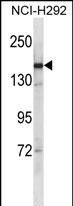 SYCP2 Antibody in Western Blot (WB)