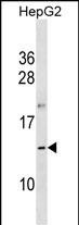 OOSP1 Antibody in Western Blot (WB)