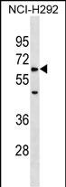 ZRSR1 Antibody in Western Blot (WB)