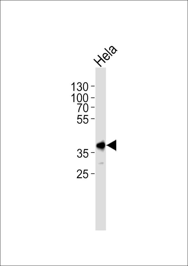 PBK Antibody in Western Blot (WB)