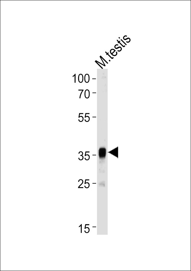 PBK Antibody in Western Blot (WB)