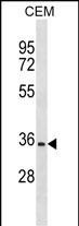 OR2A12 Antibody in Western Blot (WB)