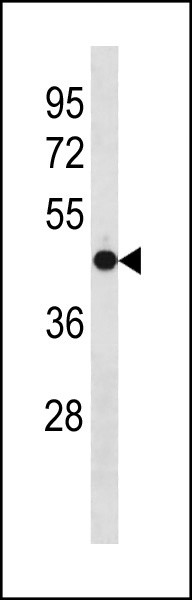 OLFM3 Antibody in Western Blot (WB)