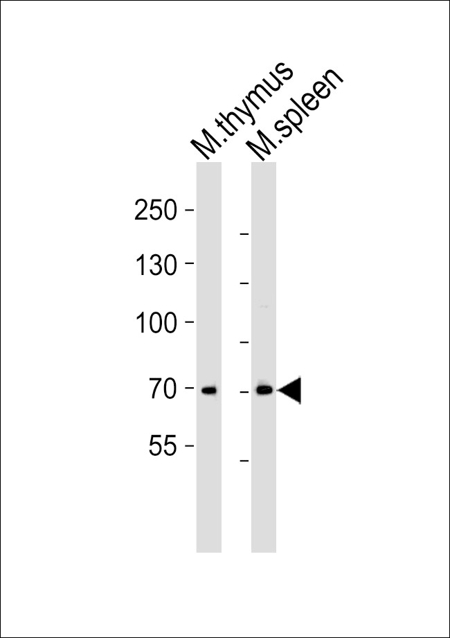 ITK Antibody in Western Blot (WB)