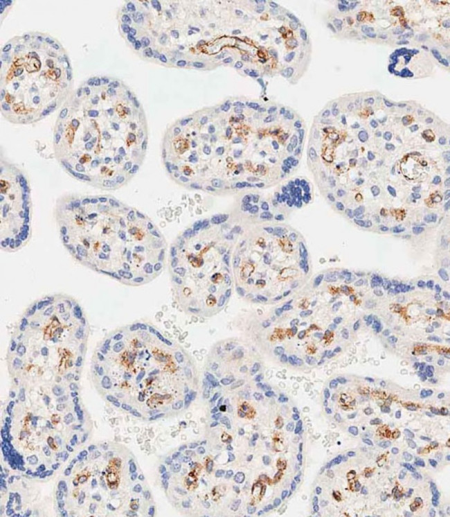 EHD2 Antibody in Immunohistochemistry (Paraffin) (IHC (P))