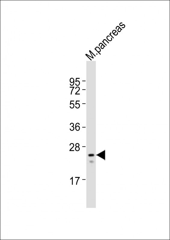 MESP1 Antibody in Western Blot (WB)