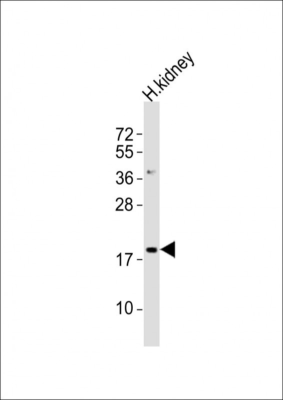 NFE4 Antibody in Western Blot (WB)