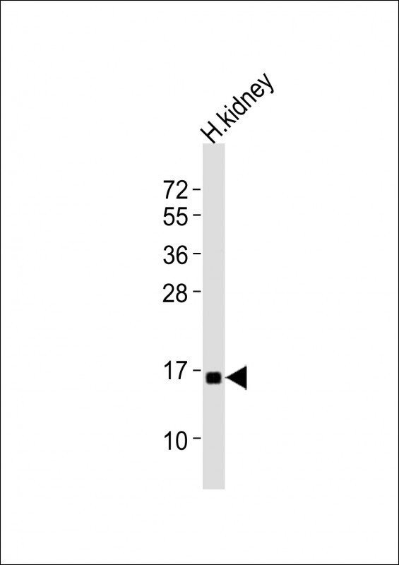 NFE4 Antibody in Western Blot (WB)