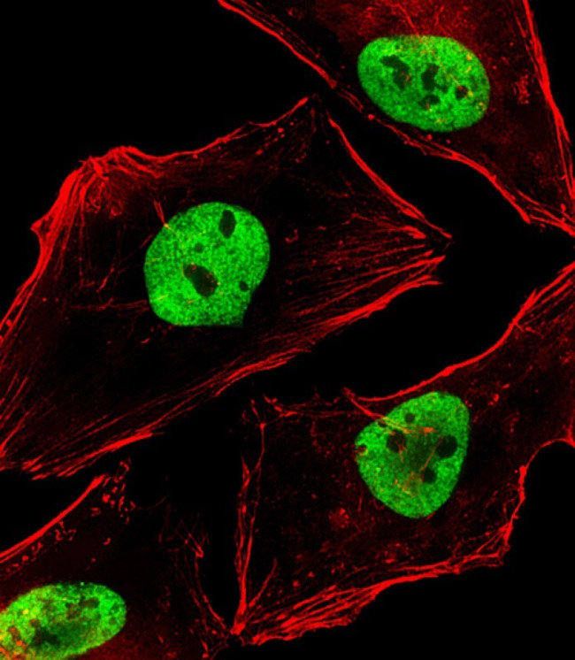 BCL9 Antibody in Immunocytochemistry (ICC/IF)