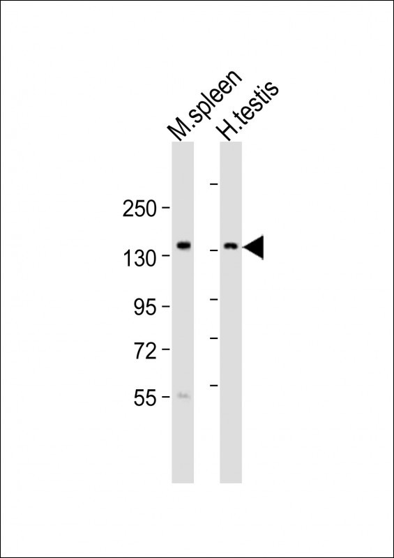 BCL9 Antibody in Western Blot (WB)