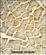 PI4KB Antibody in Immunohistochemistry (Paraffin) (IHC (P))