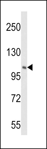 PI4KB Antibody in Western Blot (WB)