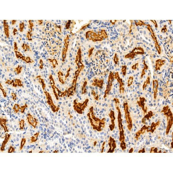 KISS1R Antibody in Immunohistochemistry (Paraffin) (IHC (P))