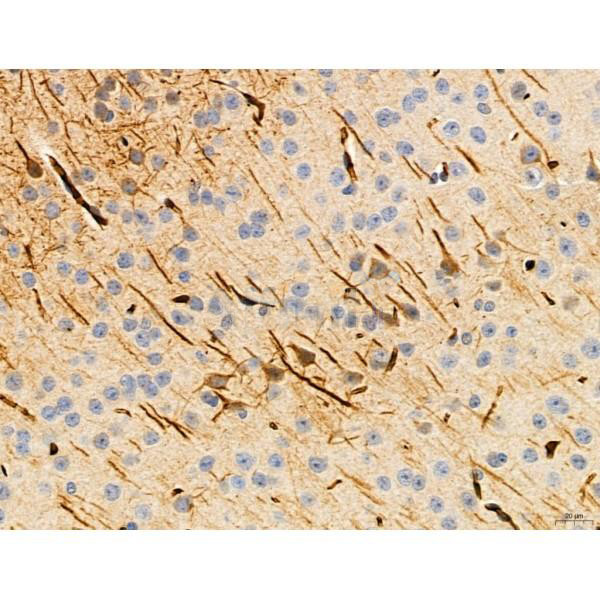 KISS1R Antibody in Immunohistochemistry (Paraffin) (IHC (P))