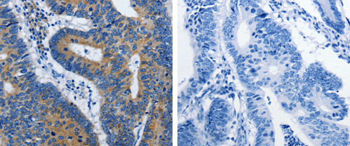 BPIFB3 Antibody in Immunohistochemistry (Paraffin) (IHC (P))