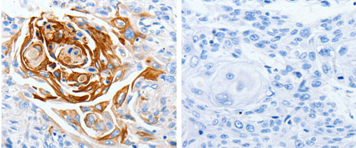 LPAR4 Antibody in Immunohistochemistry (Paraffin) (IHC (P))