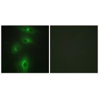 TMPRSS3 Antibody in Immunocytochemistry (ICC/IF)