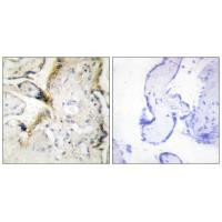 Laminin alpha-2 Antibody in Immunohistochemistry (Paraffin) (IHC (P))