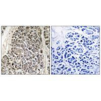 MRPS21 Antibody in Immunohistochemistry (Paraffin) (IHC (P))