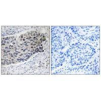 Pyruvate Carboxylase Antibody in Immunohistochemistry (Paraffin) (IHC (P))