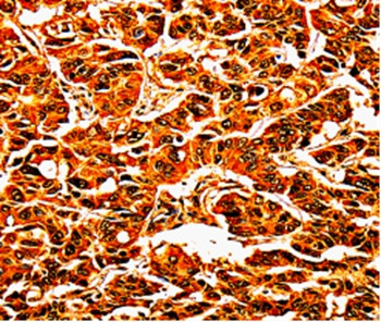 UPK3B Antibody in Immunohistochemistry (Paraffin) (IHC (P))