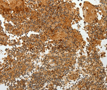 TFF2 Antibody in Immunohistochemistry (Paraffin) (IHC (P))