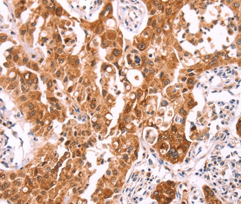 NCEH1 Antibody in Immunohistochemistry (Paraffin) (IHC (P))