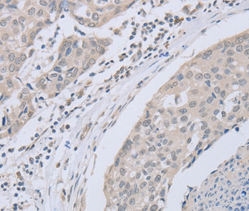 ABLIM1 Antibody in Immunohistochemistry (Paraffin) (IHC (P))