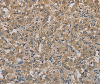 AGTRAP Antibody in Immunohistochemistry (Paraffin) (IHC (P))