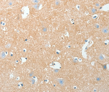 AKAP7 Antibody in Immunohistochemistry (Paraffin) (IHC (P))