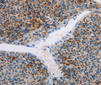 APOBEC4 Antibody in Immunohistochemistry (Paraffin) (IHC (P))