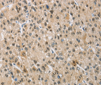 NAPSA Antibody in Immunohistochemistry (Paraffin) (IHC (P))