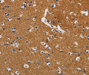 GPM6A Antibody in Immunohistochemistry (Paraffin) (IHC (P))