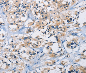 CARD14 Antibody in Immunohistochemistry (Paraffin) (IHC (P))