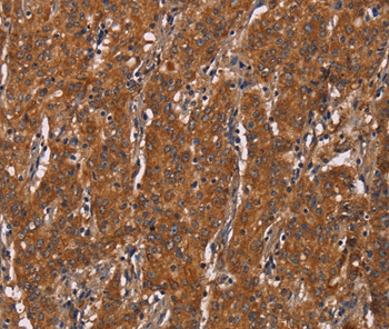 DCTN6 Antibody in Immunohistochemistry (Paraffin) (IHC (P))