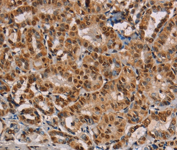 RBMX Antibody in Immunohistochemistry (Paraffin) (IHC (P))