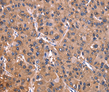 ADM2 Antibody in Immunohistochemistry (Paraffin) (IHC (P))