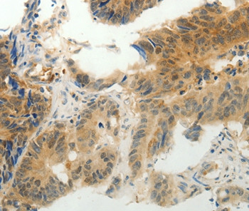 CMTM7 Antibody in Immunohistochemistry (Paraffin) (IHC (P))