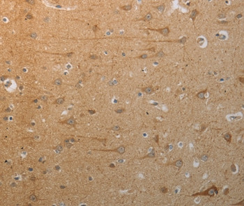 SLC4A7 Antibody in Immunohistochemistry (Paraffin) (IHC (P))