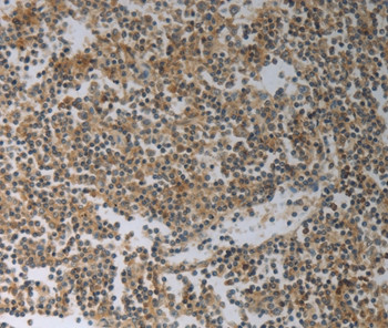 SLC4A7 Antibody in Immunohistochemistry (Paraffin) (IHC (P))